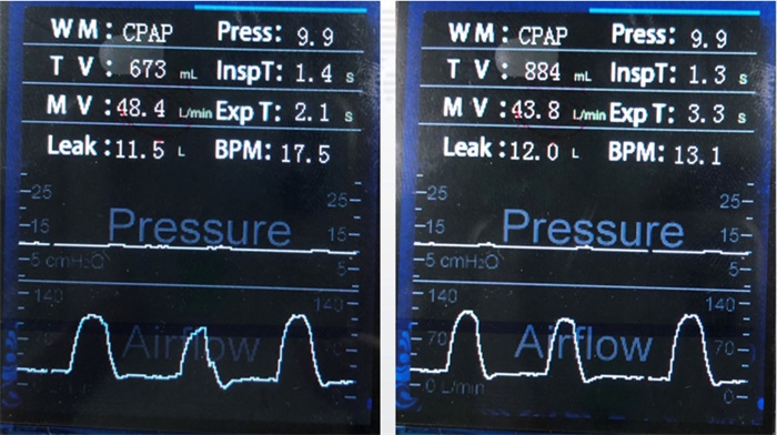 Performance Parameters(1) Auto CPAP Performance Parameters(1) Auto CPAP